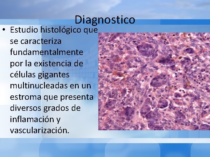 Diagnostico • Estudio histológico que se caracteriza fundamentalmente por la existencia de células gigantes