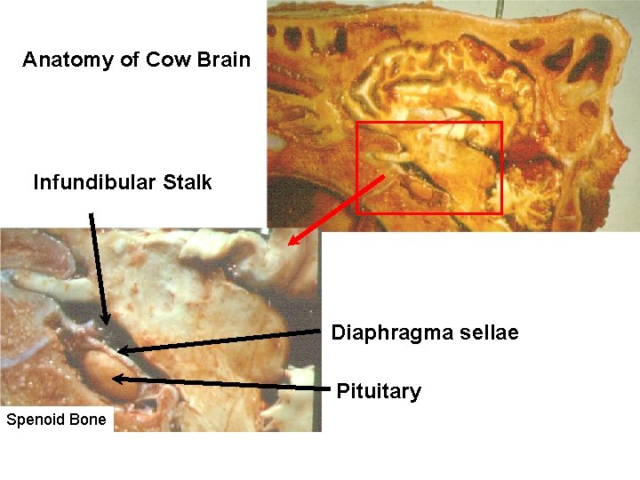 Anatomy of Cow Brain Infundibular Stalk Diaphragma sellae Pituitary Spenoid Bone 