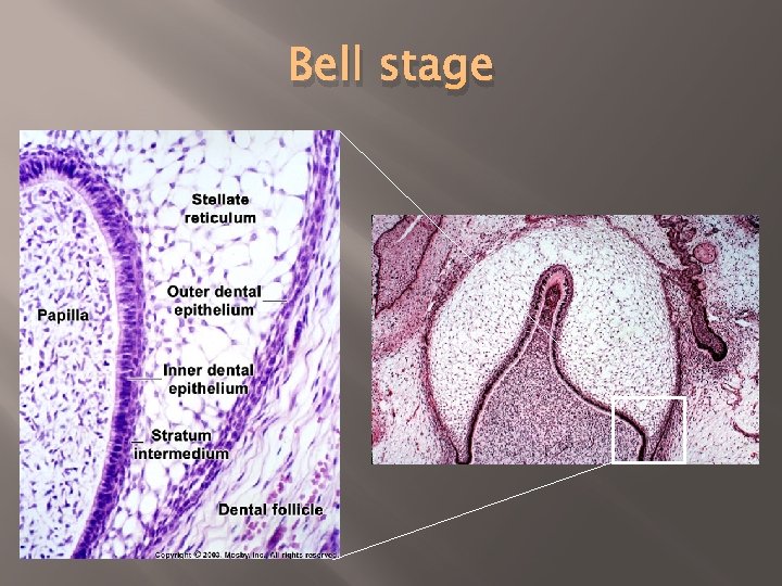 Bell stage 