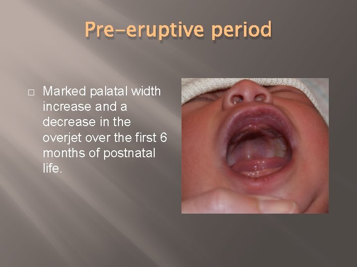 Pre-eruptive period � Marked palatal width increase and a decrease in the overjet over