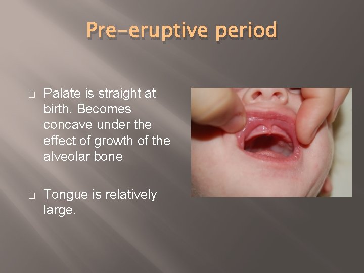 Pre-eruptive period � Palate is straight at birth. Becomes concave under the effect of