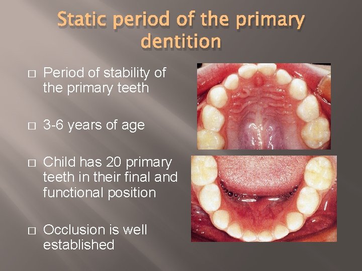 Static period of the primary dentition � Period of stability of the primary teeth