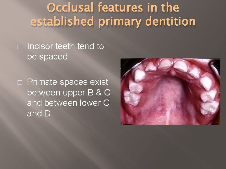 Occlusal features in the established primary dentition � Incisor teeth tend to be spaced