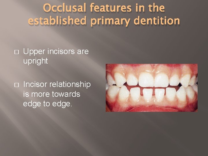 Occlusal features in the established primary dentition � Upper incisors are upright � Incisor