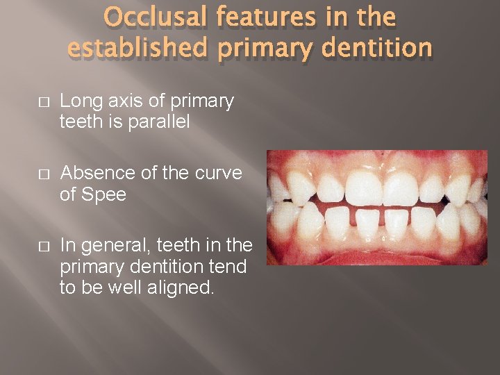 Occlusal features in the established primary dentition � Long axis of primary teeth is