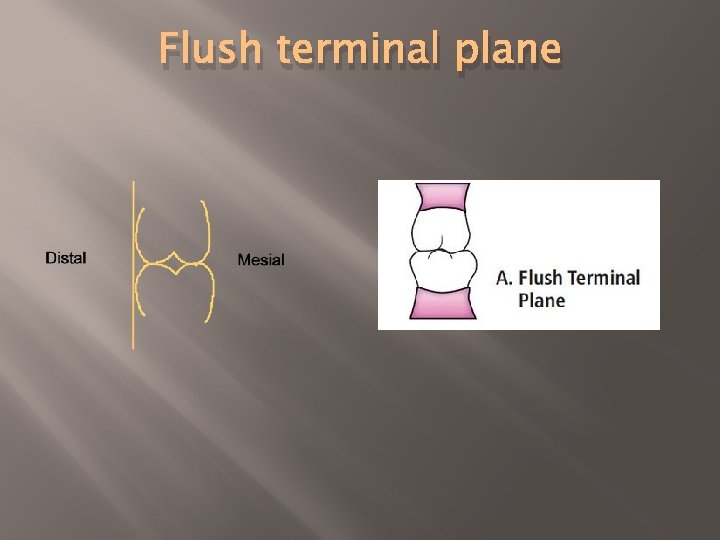 Flush terminal plane 