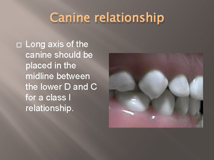 Canine relationship � Long axis of the canine should be placed in the midline