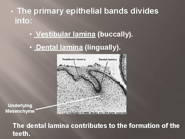  • The primary epithelial bands divides into: • Vestibular lamina (buccally). • Dental