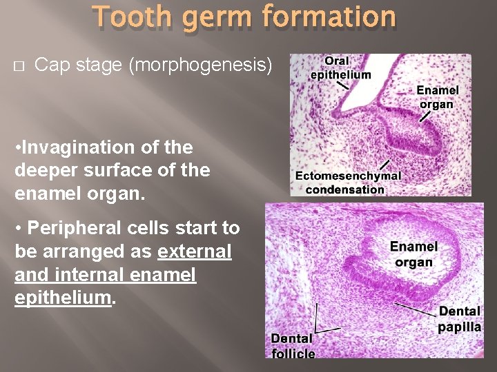 Tooth germ formation � Cap stage (morphogenesis) • Invagination of the deeper surface of