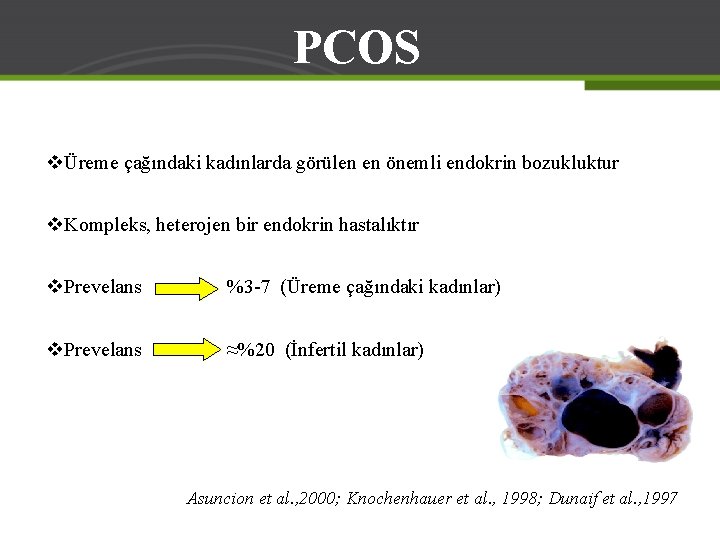 PCOS vÜreme çağındaki kadınlarda görülen en önemli endokrin bozukluktur v. Kompleks, heterojen bir endokrin