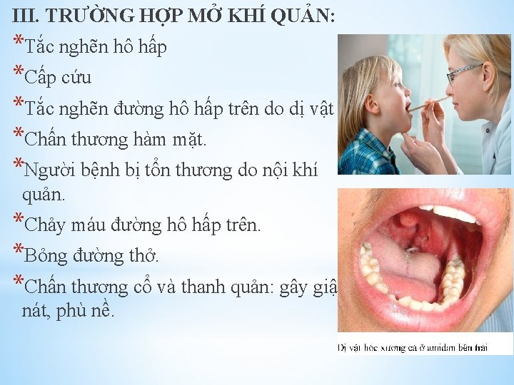 III. TRƯỜNG HỢP MỞ KHÍ QUẢN: *Tắc nghẽn hô hấp *Cấp cứu *Tắc nghẽn