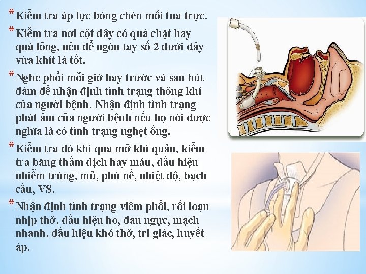 *Kiểm tra áp lực bóng chèn mỗi tua trực. *Kiểm tra nơi cột dây