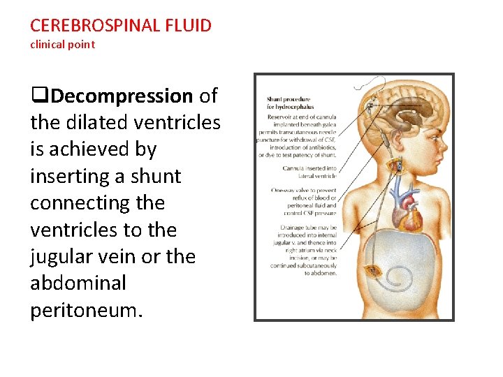 CEREBROSPINAL FLUID clinical point q. Decompression of the dilated ventricles is achieved by inserting