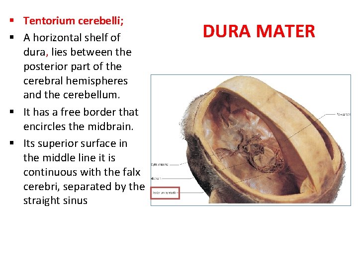 § Tentorium cerebelli; § A horizontal shelf of dura, lies between the posterior part