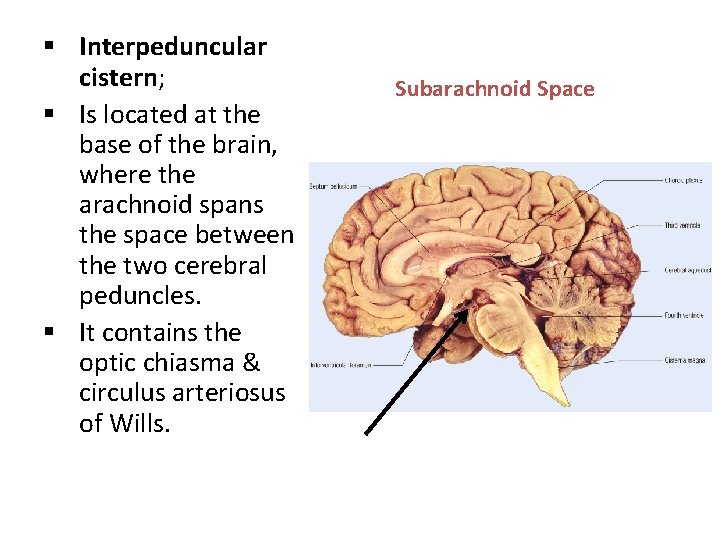 § Interpeduncular cistern; § Is located at the base of the brain, where the