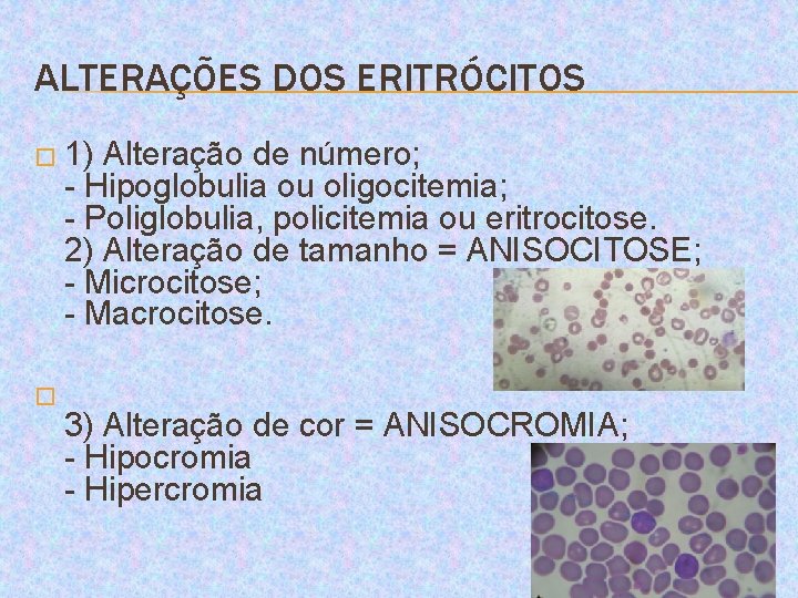 ALTERAÇÕES DOS ERITRÓCITOS � 1) Alteração de número; - Hipoglobulia ou oligocitemia; - Poliglobulia,