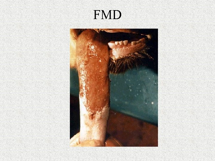 FMD 