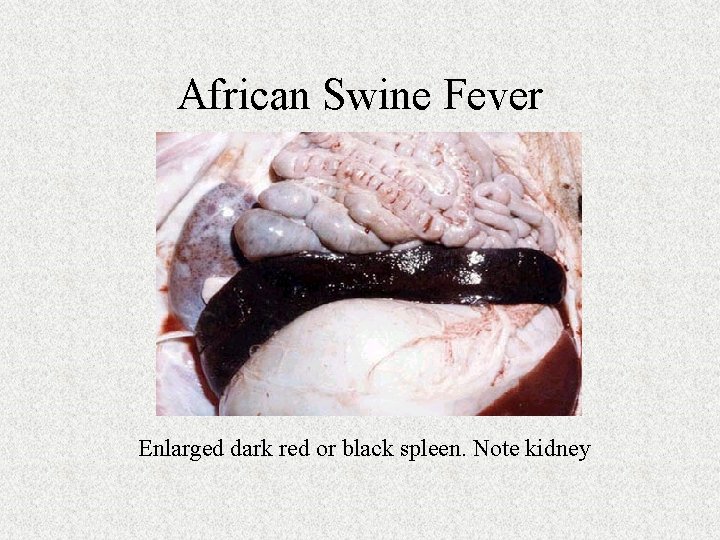 African Swine Fever Enlarged dark red or black spleen. Note kidney 