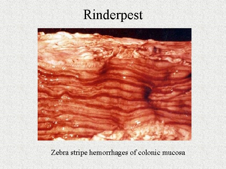 Rinderpest Zebra stripe hemorrhages of colonic mucosa 