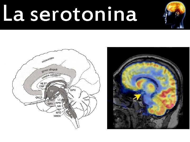 La serotonina 