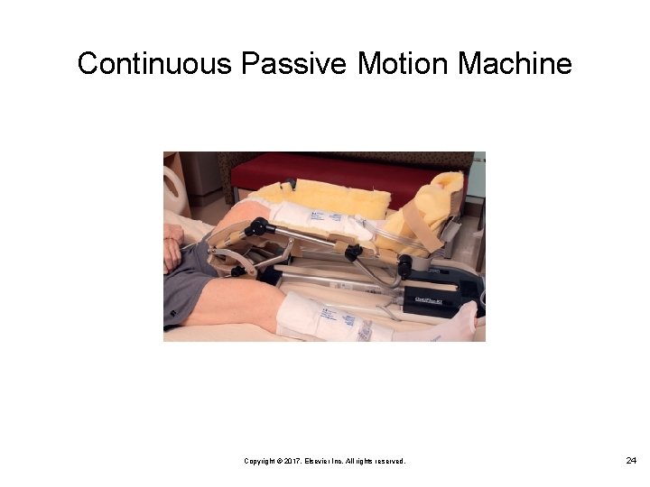 Continuous Passive Motion Machine Copyright © 2017, Elsevier Inc. All rights reserved. 24 
