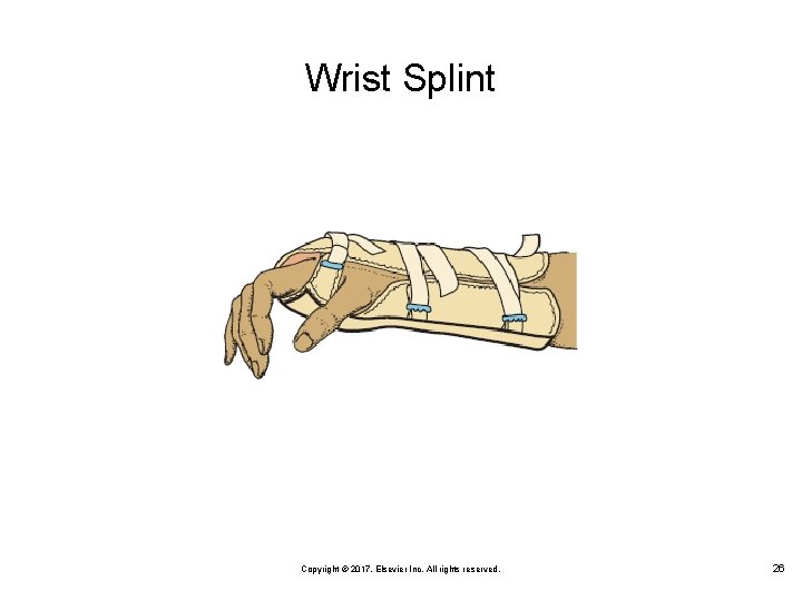 Wrist Splint Copyright © 2017, Elsevier Inc. All rights reserved. 26 