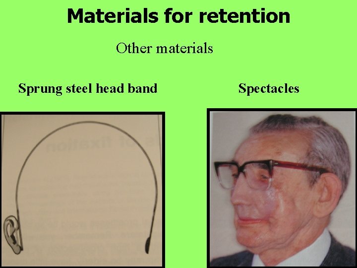 Materials for retention Other materials Sprung steel head band Spectacles 