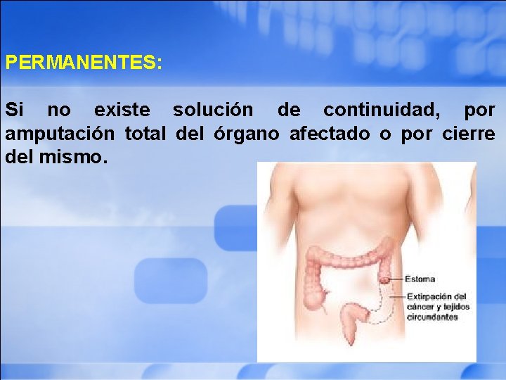 PERMANENTES: Si no existe solución de continuidad, por amputación total del órgano afectado o