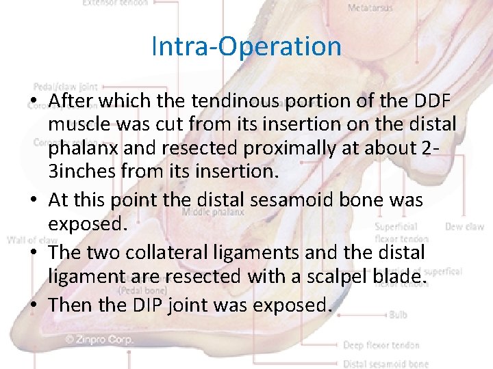 Intra-Operation • After which the tendinous portion of the DDF muscle was cut from