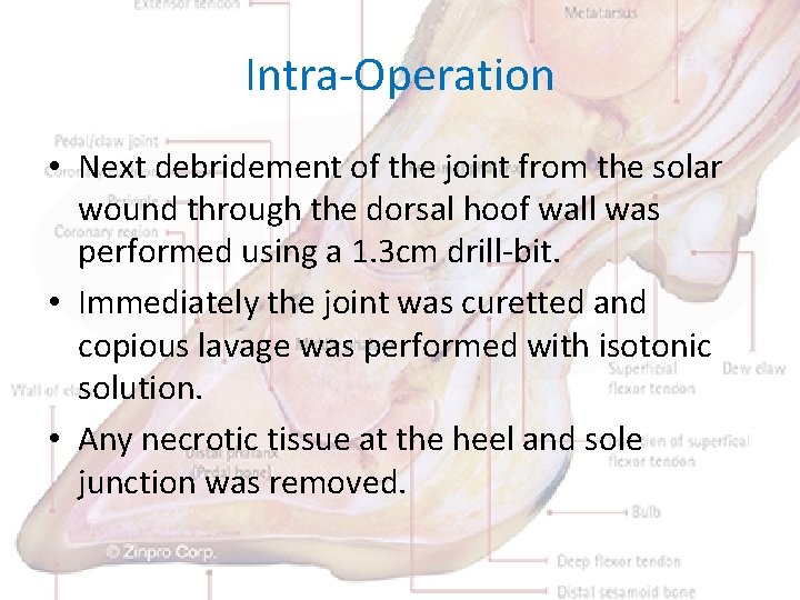Intra-Operation • Next debridement of the joint from the solar wound through the dorsal