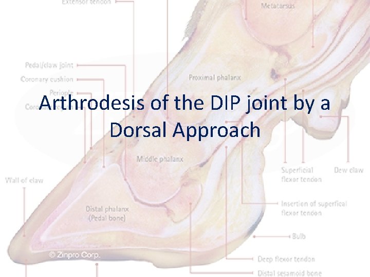 Arthrodesis of the DIP joint by a Dorsal Approach 