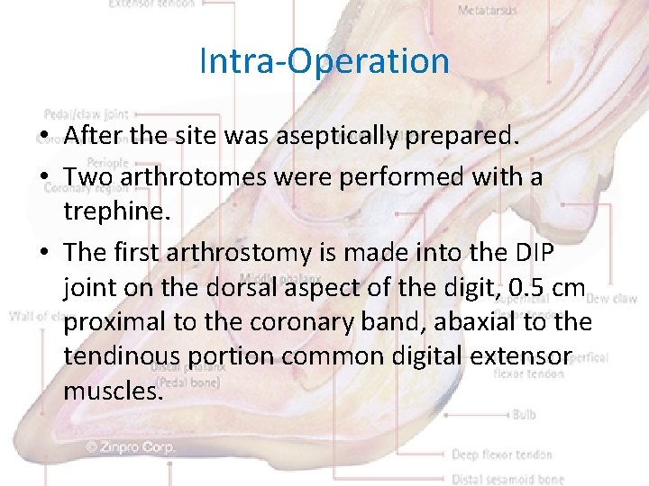 Intra-Operation • After the site was aseptically prepared. • Two arthrotomes were performed with