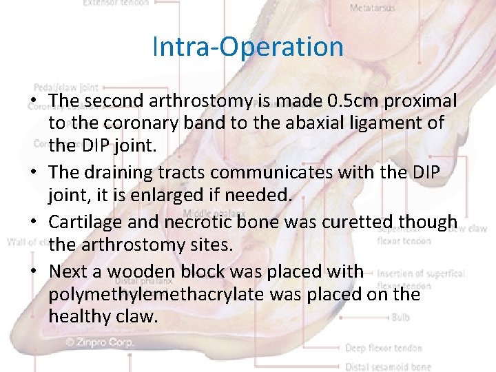 Intra-Operation • The second arthrostomy is made 0. 5 cm proximal to the coronary