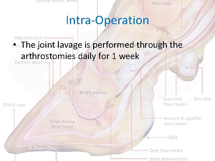 Intra-Operation • The joint lavage is performed through the arthrostomies daily for 1 week