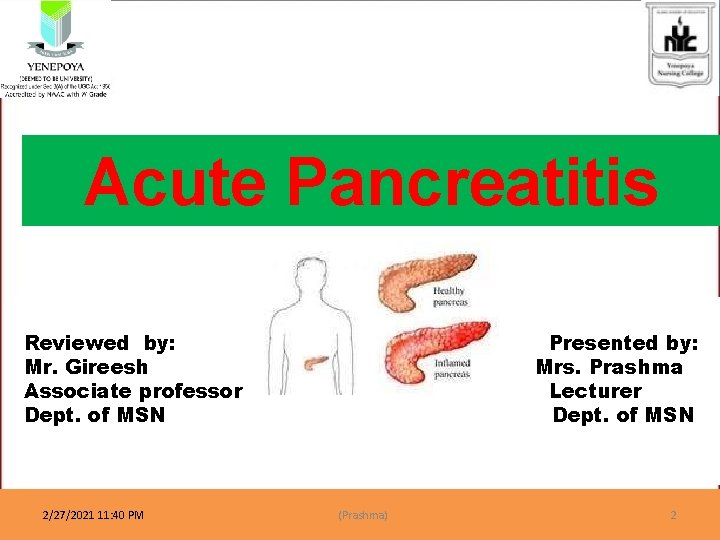 Acute Pancreatitis Reviewed by: Mr. Gireesh Associate professor Dept. of MSN 2/27/2021 11: 40 Acute Pancreatitis Reviewed by: Mr. Gireesh Associate professor Dept. of MSN 2/27/2021 11: 40