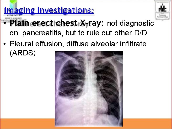Imaging Investigations: • Plain erect chest X-ray: not diagnostic on pancreatitis, but to rule Imaging Investigations: • Plain erect chest X-ray: not diagnostic on pancreatitis, but to rule