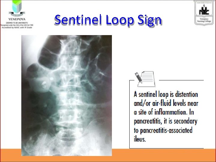 Sentinel Loop Sign Sentinel Loop Sign