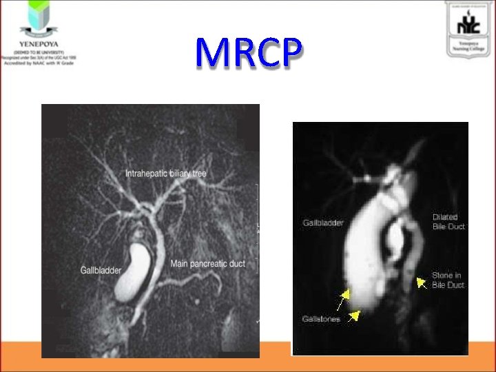 MRCP MRCP