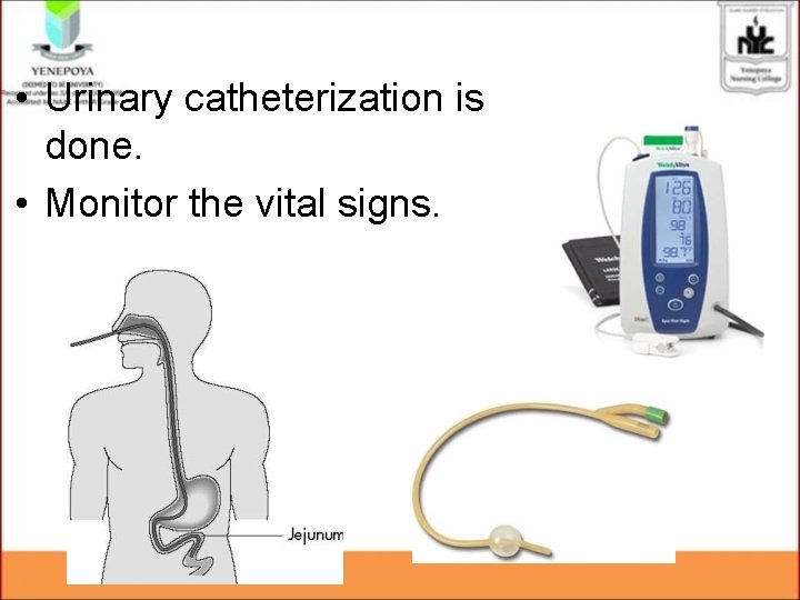 • Urinary catheterization is done. • Monitor the vital signs. • Urinary catheterization is done. • Monitor the vital signs.