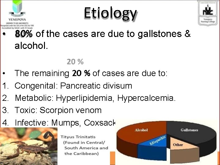Etiology • 80% of the cases are due to gallstones & alcohol. • 1. Etiology • 80% of the cases are due to gallstones & alcohol. • 1.