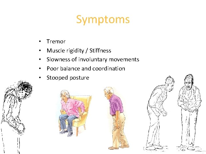 Symptoms • • • Tremor Muscle rigidity / Stiffness Slowness of involuntary movements Poor