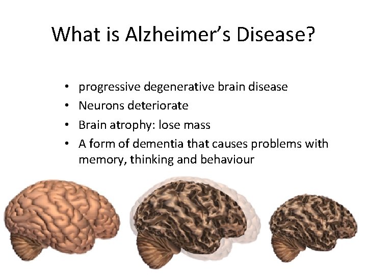 What is Alzheimer’s Disease? • • progressive degenerative brain disease Neurons deteriorate Brain atrophy:
