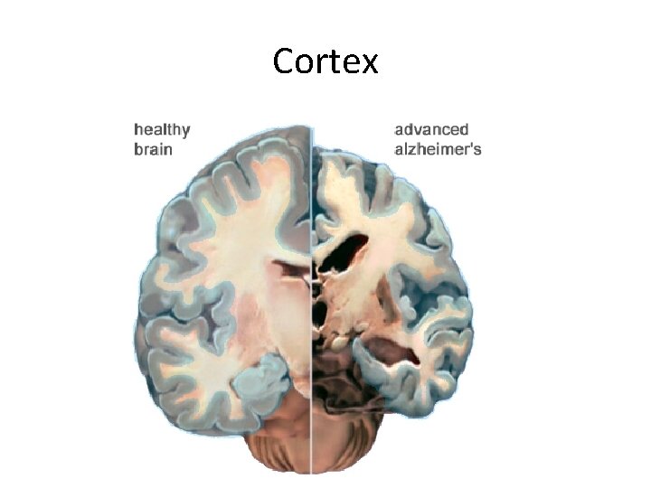 Cortex 