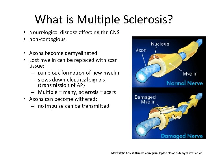 What is Multiple Sclerosis? • Neurological disease affecting the CNS • non-contagious • Axons