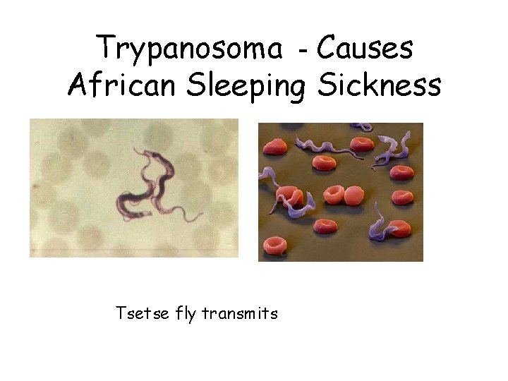 Trypanosoma - Causes African Sleeping Sickness Tsetse fly transmits 