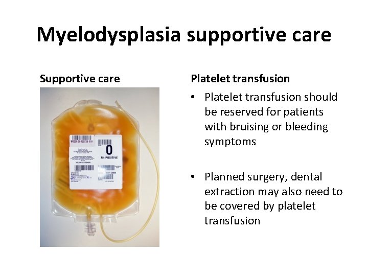 Myelodysplasia supportive care Supportive care Platelet transfusion • Platelet transfusion should be reserved for
