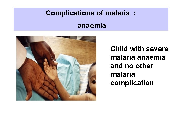 Complications of malaria : anaemia Child with severe malaria anaemia and no other malaria Complications of malaria : anaemia Child with severe malaria anaemia and no other malaria