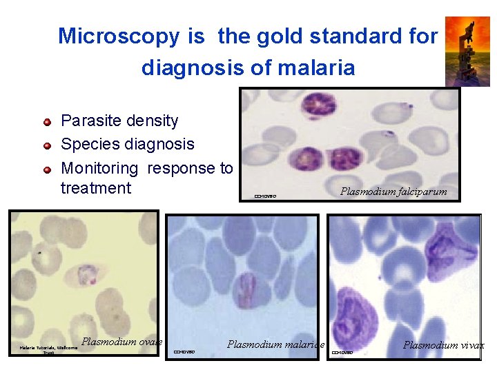 Microscopy is the gold standard for diagnosis of malaria Parasite density Species diagnosis Monitoring Microscopy is the gold standard for diagnosis of malaria Parasite density Species diagnosis Monitoring