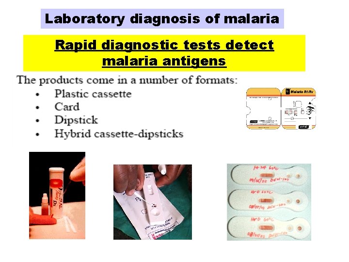 Laboratory diagnosis of malaria Rapid diagnostic tests detect malaria antigens Laboratory diagnosis of malaria Rapid diagnostic tests detect malaria antigens