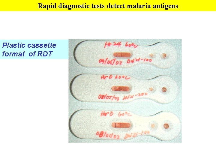 Rapid diagnostic tests detect malaria antigens Plastic cassette format of RDT Rapid diagnostic tests detect malaria antigens Plastic cassette format of RDT